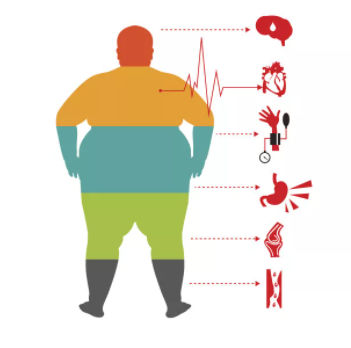 长胖的3个层面——《柳叶刀》剖析中国肥胖问题